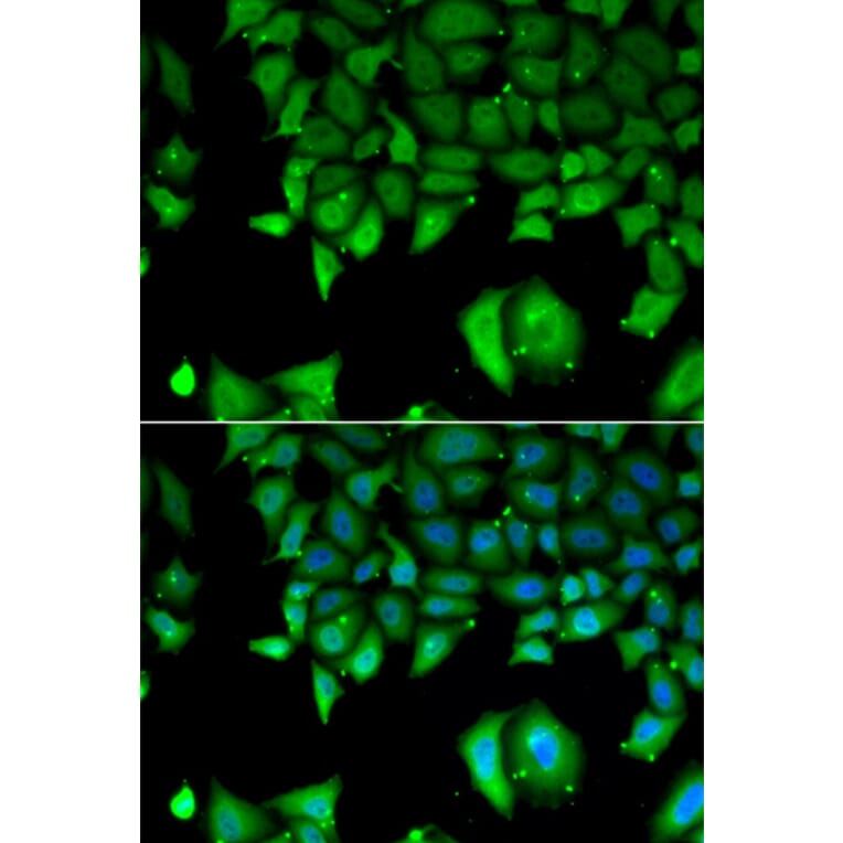 Immunofluorescence - IL17F antibody from Signalway Antibody (38959) - Antibodies.com