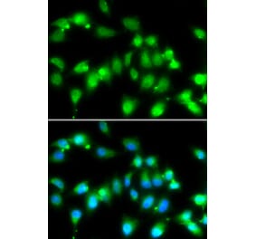 Immunofluorescence - AKAP5 antibody from Signalway Antibody (38974) - Antibodies.com