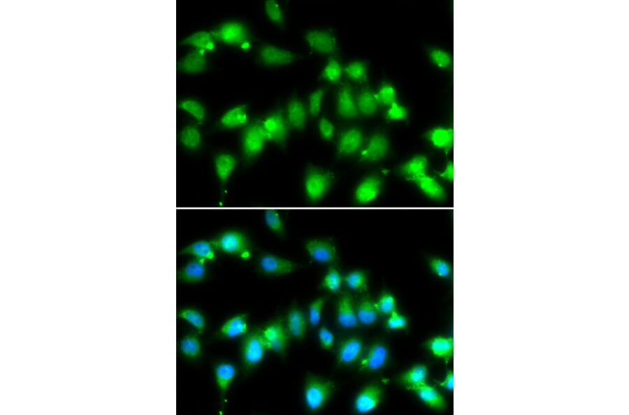 Immunofluorescence - AKAP5 antibody from Signalway Antibody (38974) - Antibodies.com