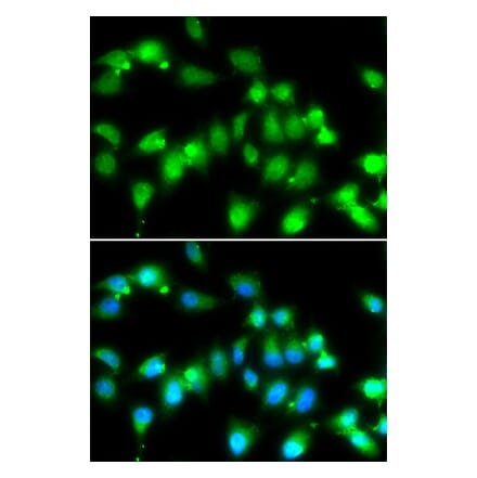 Immunofluorescence - AKAP5 antibody from Signalway Antibody (38974) - Antibodies.com