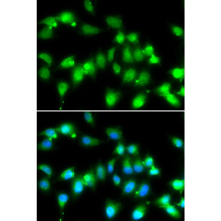 Immunofluorescence - AKAP5 antibody from Signalway Antibody (38974) - Antibodies.com