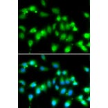 Immunofluorescence - AKAP5 antibody from Signalway Antibody (38974) - Antibodies.com