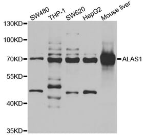 Western blot - ALAS1 antibody from Signalway Antibody (38975) - Antibodies.com