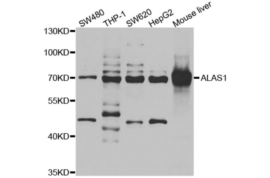Western blot - ALAS1 antibody from Signalway Antibody (38975) - Antibodies.com