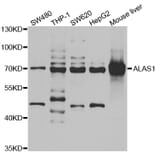 Western blot - ALAS1 antibody from Signalway Antibody (38975) - Antibodies.com