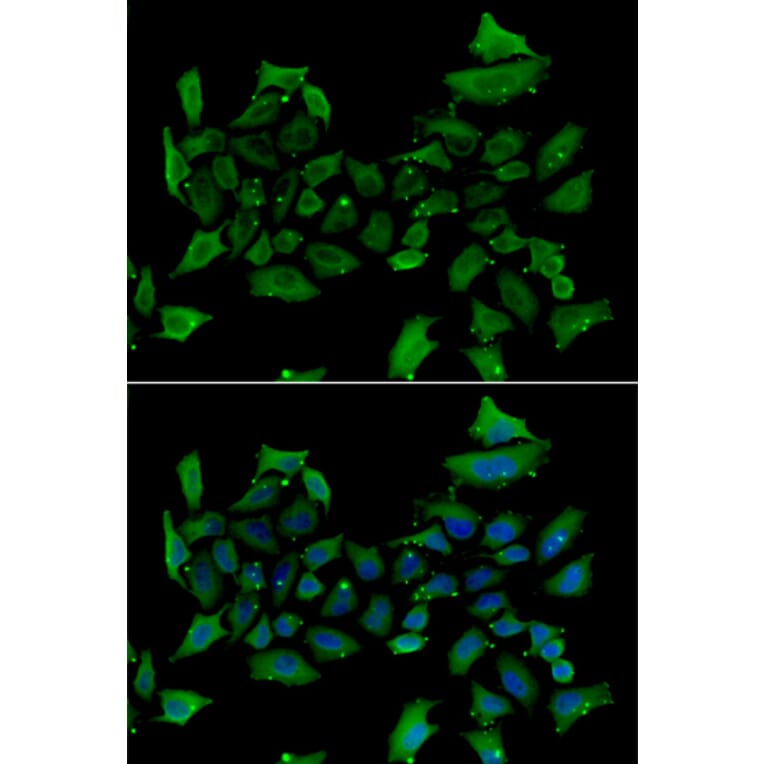 Immunofluorescence - ALAS1 antibody from Signalway Antibody (38975) - Antibodies.com