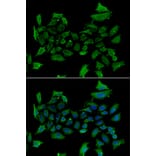 Immunofluorescence - ALAS1 antibody from Signalway Antibody (38975) - Antibodies.com