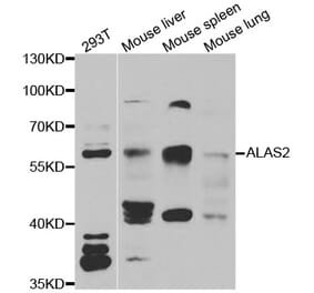 Western blot - ALAS2 antibody from Signalway Antibody (38976) - Antibodies.com