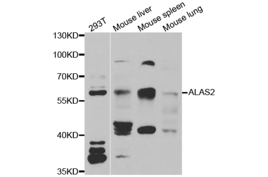 Western blot - ALAS2 antibody from Signalway Antibody (38976) - Antibodies.com