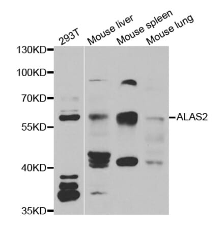 Western blot - ALAS2 antibody from Signalway Antibody (38976) - Antibodies.com