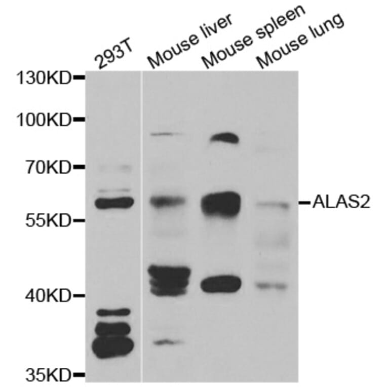 Western blot - ALAS2 antibody from Signalway Antibody (38976) - Antibodies.com