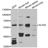 Western blot - ALAS2 antibody from Signalway Antibody (38976) - Antibodies.com