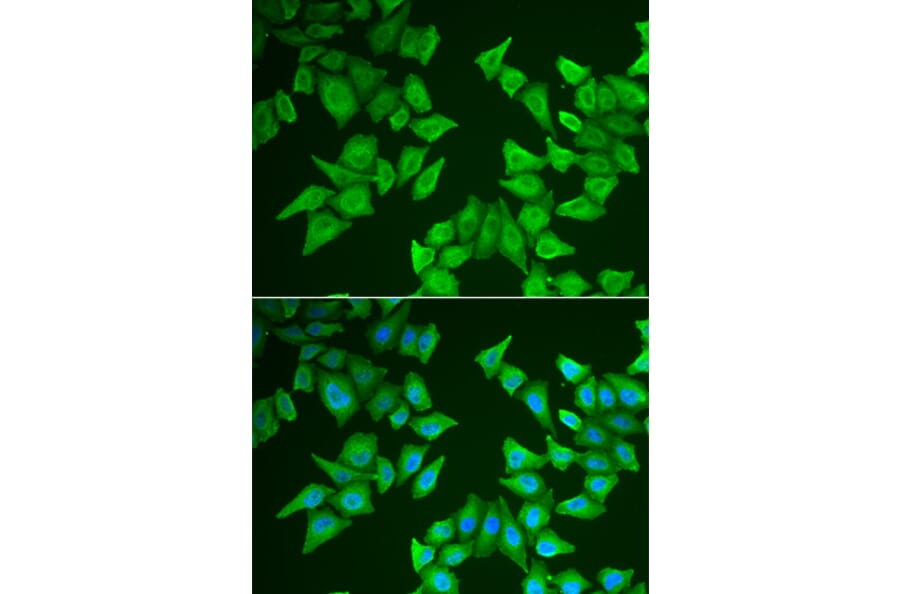 Immunofluorescence - ALAS2 antibody from Signalway Antibody (38976) - Antibodies.com