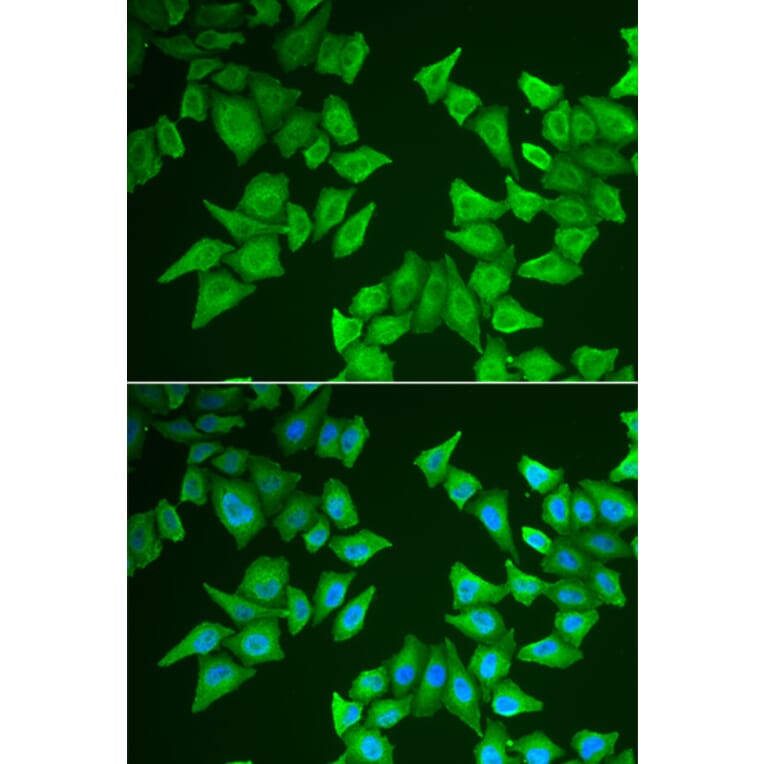 Immunofluorescence - ALAS2 antibody from Signalway Antibody (38976) - Antibodies.com