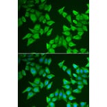 Immunofluorescence - ALAS2 antibody from Signalway Antibody (38976) - Antibodies.com