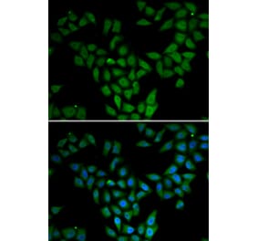 Immunofluorescence - ASF1A antibody from Signalway Antibody (38981) - Antibodies.com