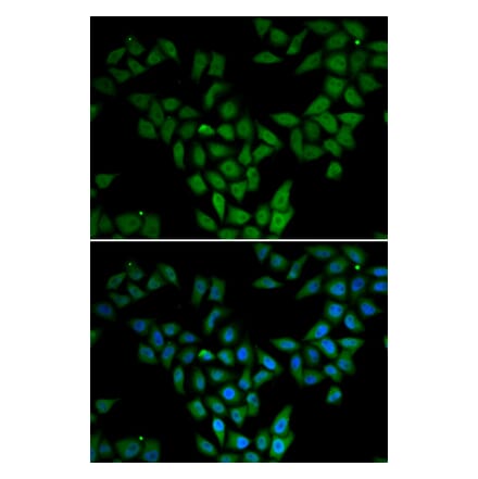Immunofluorescence - ASF1A antibody from Signalway Antibody (38981) - Antibodies.com