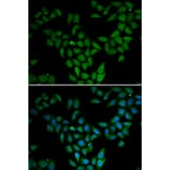 Immunofluorescence - ASF1A antibody from Signalway Antibody (38981) - Antibodies.com