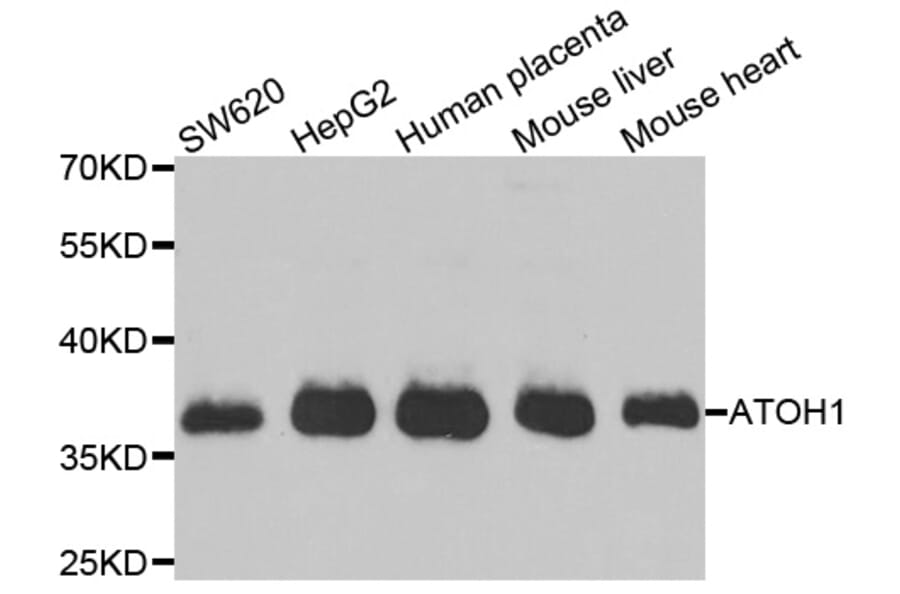 Western blot - ATOH1 antibody from Signalway Antibody (38983) - Antibodies.com
