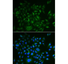 Immunofluorescence - BAMBI antibody from Signalway Antibody (38985) - Antibodies.com