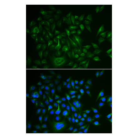 Immunofluorescence - BAMBI antibody from Signalway Antibody (38985) - Antibodies.com