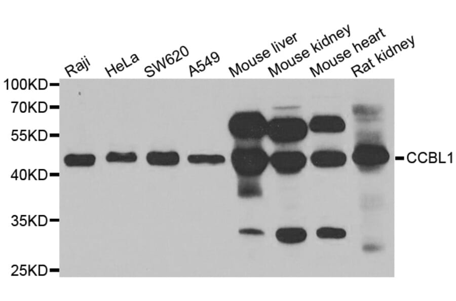 Western blot - CCBL1 antibody from Signalway Antibody (38995) - Antibodies.com