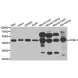 Western blot - CCBL1 antibody from Signalway Antibody (38995) - Antibodies.com
