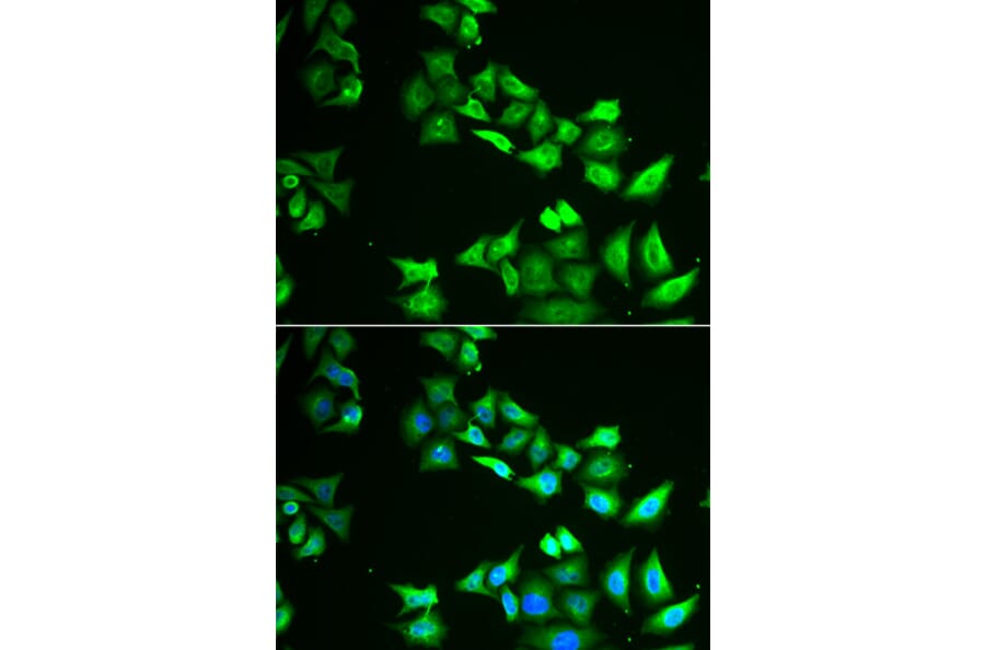 Immunofluorescence - CCBL1 antibody from Signalway Antibody (38995) - Antibodies.com
