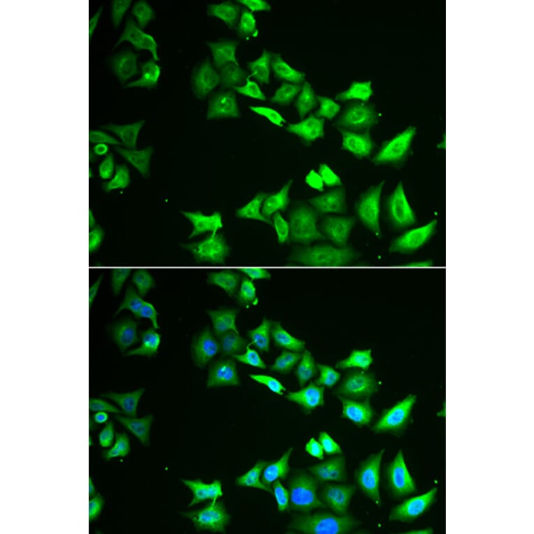 Immunofluorescence - CCBL1 antibody from Signalway Antibody (38995) - Antibodies.com
