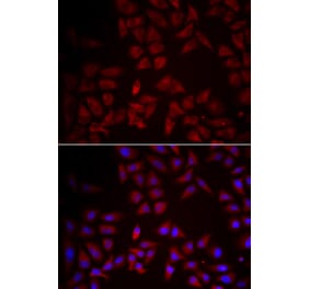 Immunofluorescence - CCL25 antibody from Signalway Antibody (38996) - Antibodies.com