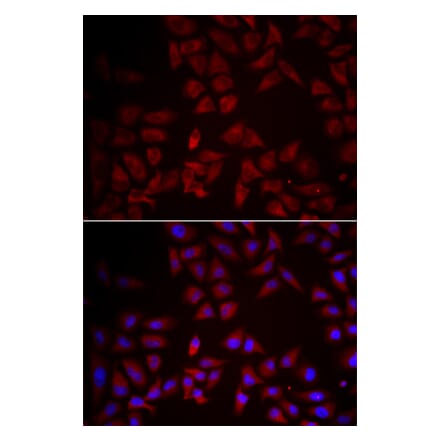 Immunofluorescence - CCL25 antibody from Signalway Antibody (38996) - Antibodies.com
