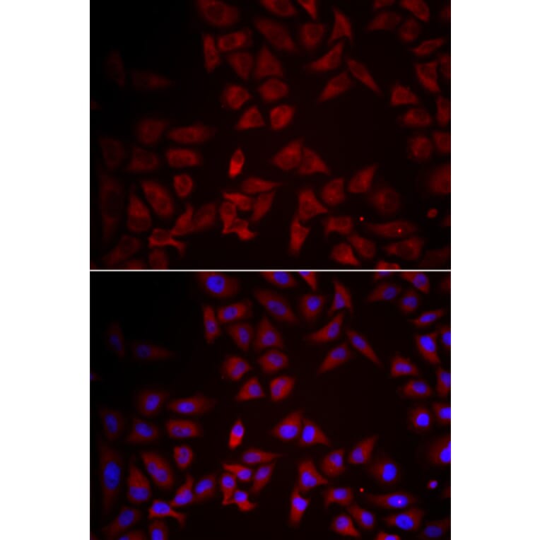 Immunofluorescence - CCL25 antibody from Signalway Antibody (38996) - Antibodies.com