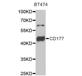 Western blot - CD177 antibody from Signalway Antibody (39002) - Antibodies.com