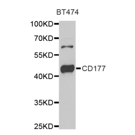 Western blot - CD177 antibody from Signalway Antibody (39002) - Antibodies.com