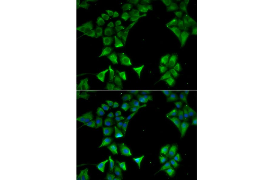 Immunofluorescence - CD177 antibody from Signalway Antibody (39002) - Antibodies.com