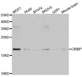 Western blot - CIRBP antibody from Signalway Antibody (39007) - Antibodies.com