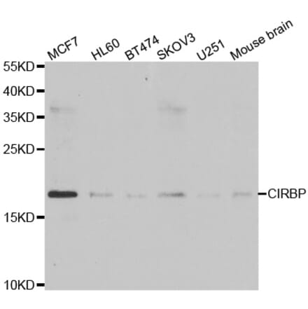 Western blot - CIRBP antibody from Signalway Antibody (39007) - Antibodies.com