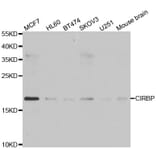 Western blot - CIRBP antibody from Signalway Antibody (39007) - Antibodies.com
