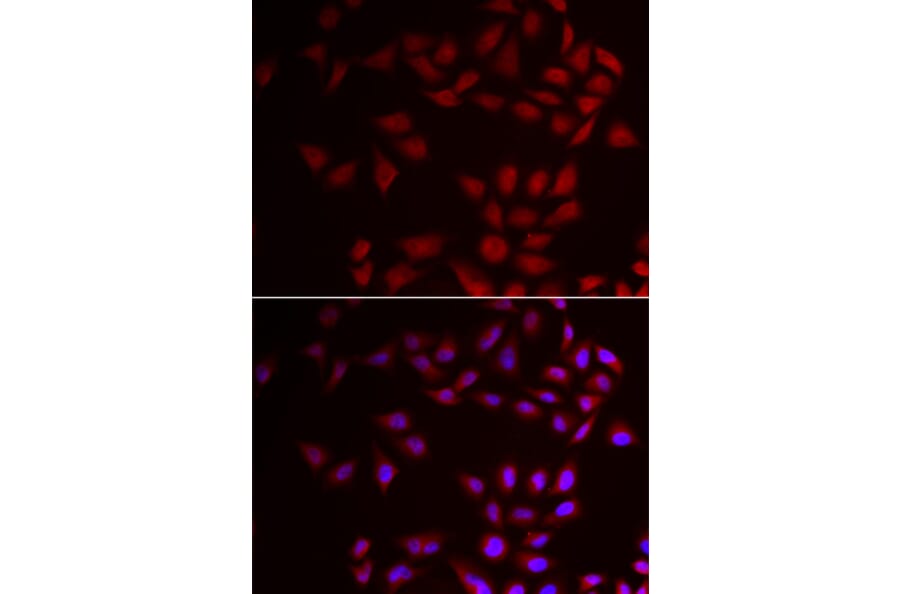 Immunofluorescence - CIRBP antibody from Signalway Antibody (39007) - Antibodies.com