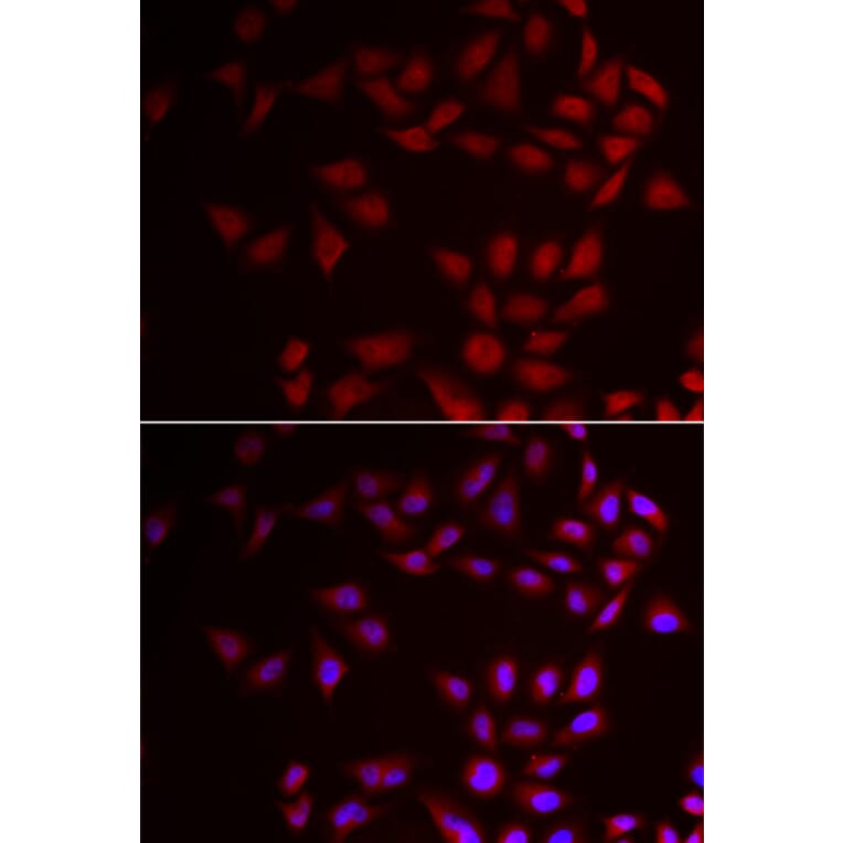 Immunofluorescence - CIRBP antibody from Signalway Antibody (39007) - Antibodies.com