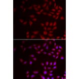 Immunofluorescence - CIRBP antibody from Signalway Antibody (39007) - Antibodies.com