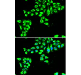 Immunofluorescence - CLDN2 antibody from Signalway Antibody (39008) - Antibodies.com
