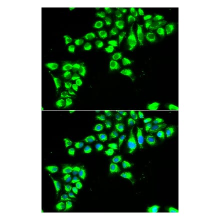 Immunofluorescence - CLDN2 antibody from Signalway Antibody (39008) - Antibodies.com