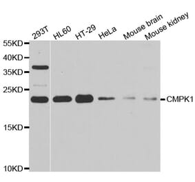 Western blot - CMPK1 antibody from Signalway Antibody (39009) - Antibodies.com