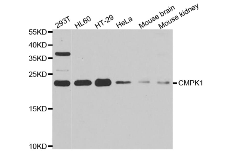 Western blot - CMPK1 antibody from Signalway Antibody (39009) - Antibodies.com