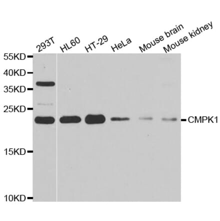 Western blot - CMPK1 antibody from Signalway Antibody (39009) - Antibodies.com