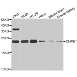 Western blot - CMPK1 antibody from Signalway Antibody (39009) - Antibodies.com