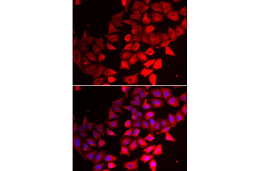 Immunofluorescence - CMPK1 antibody from Signalway Antibody (39009) - Antibodies.com