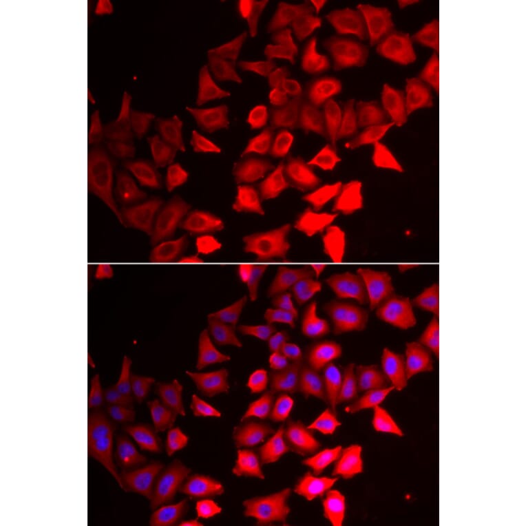 Immunofluorescence - CMPK1 antibody from Signalway Antibody (39009) - Antibodies.com