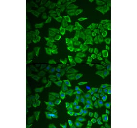 Immunofluorescence - CRHBP antibody from Signalway Antibody (39014) - Antibodies.com